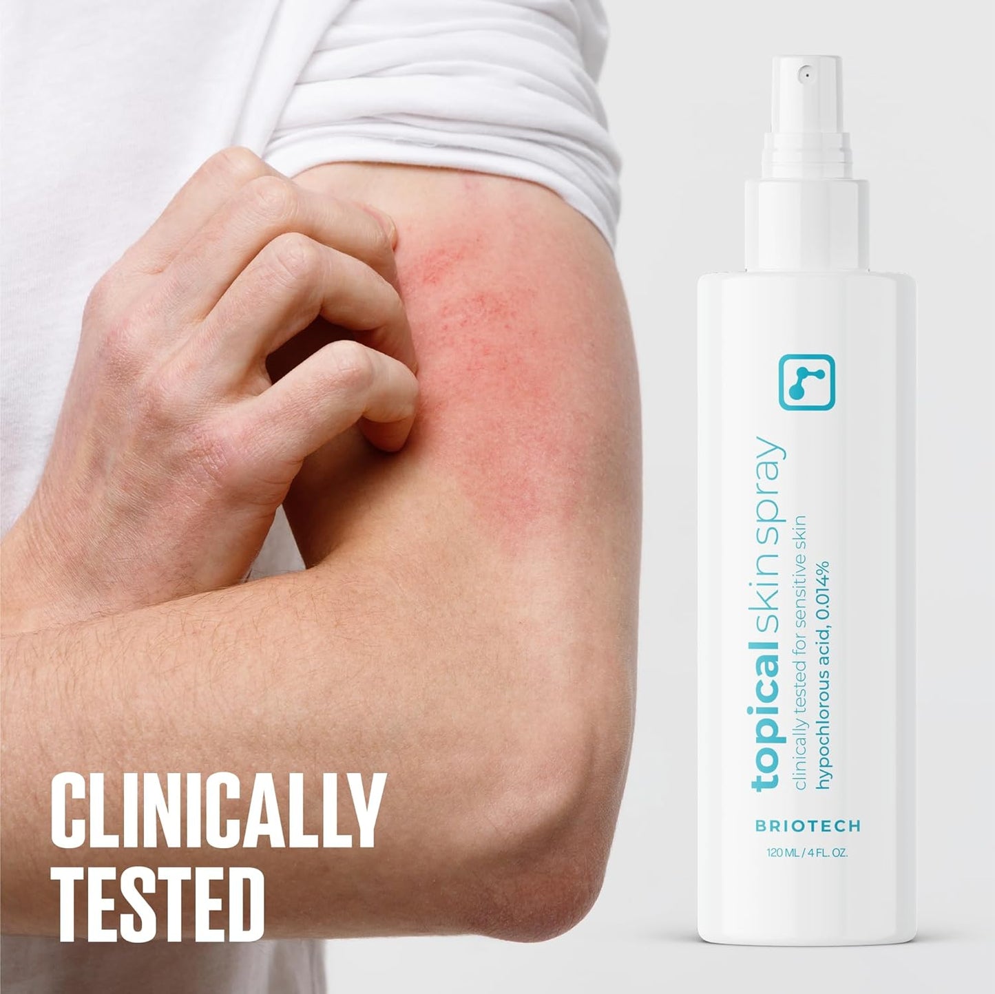 BRIOTECH Topical Skin Spray, Hypochlorous Acid Spray for Sensitive Skin, HOCl Facial Mist, Full Body Support Against Irritation, Calm Redness, Soothe Foot & Scalp, 2 oz Travel Size