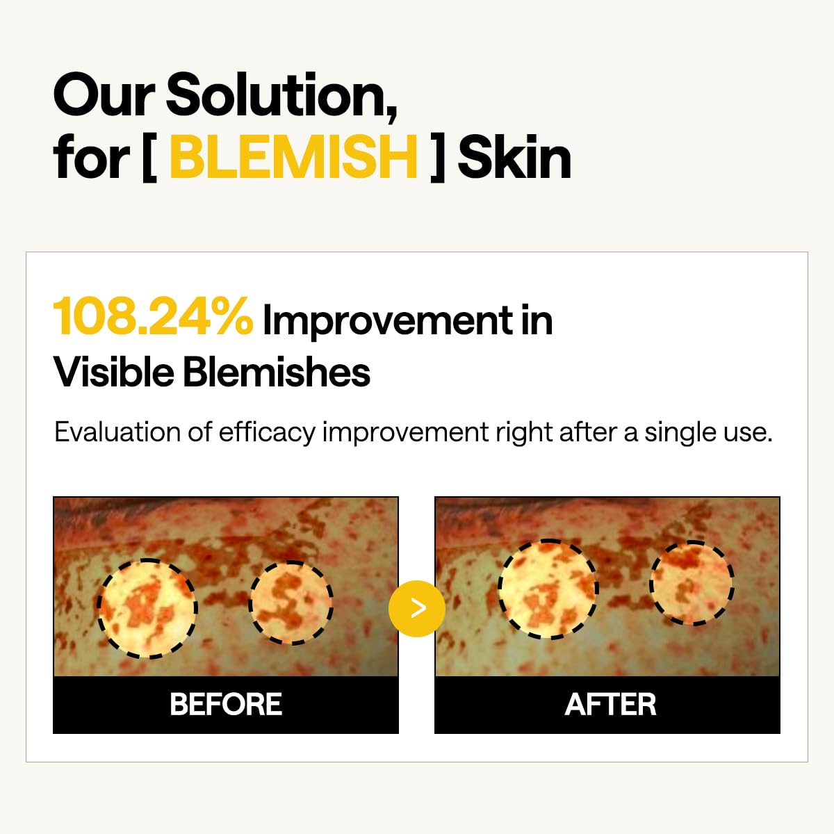 Mediheal Vita Collagen Under Eye Patches for - Korean Hydrogel Eye Pads (60 patches) with 7 Vitamin & 5 Micro Collagen. Moisturizng & Non Irritating Eye Gel Mask. Sealing Cap Included.