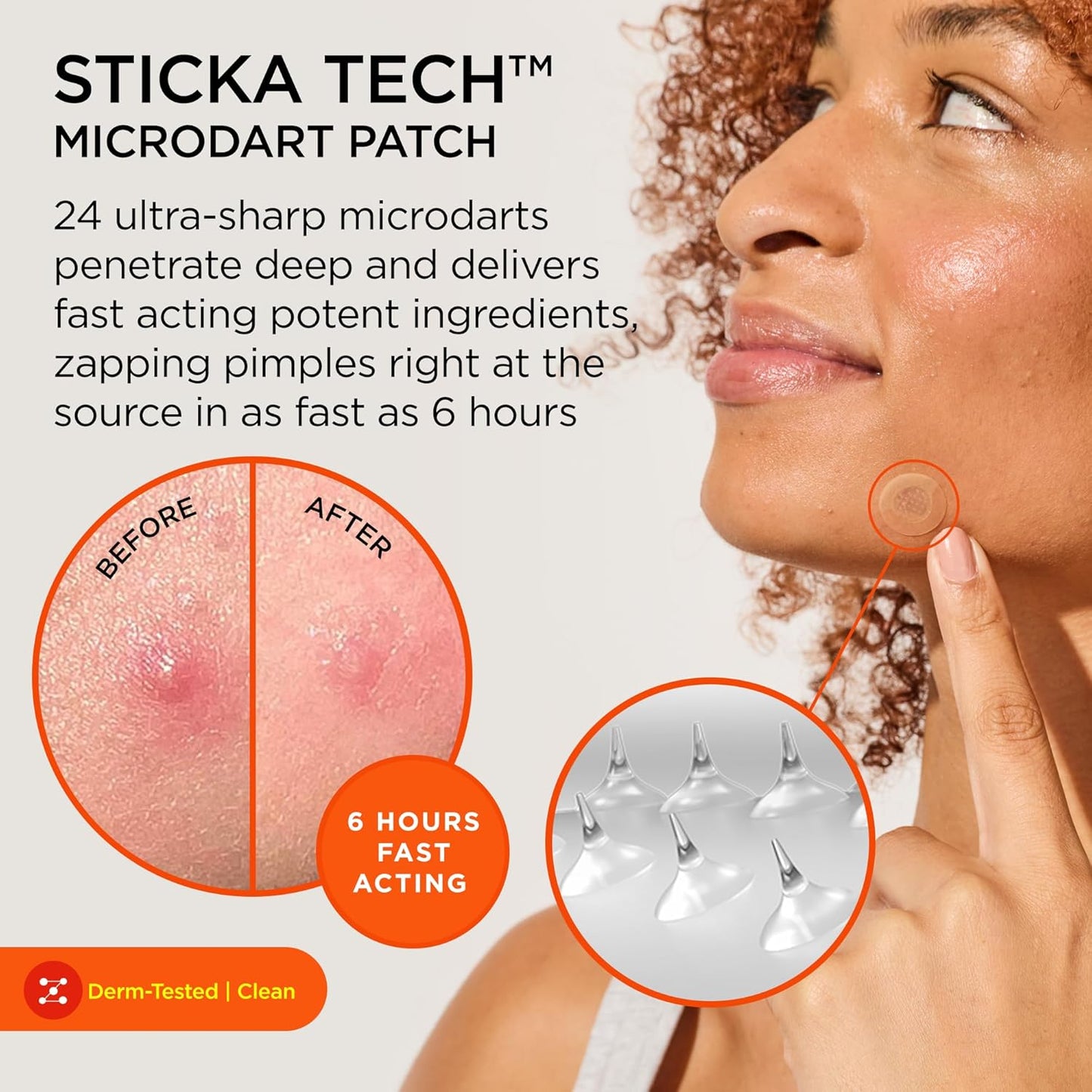 ZitSticka Killa Acne Patches for Face - World's Most Potent Pimple Patch with Fast-Acting Microdarts - Starts Working within 2 Hours for Deep, Early-Stage Zits - 20 Count
